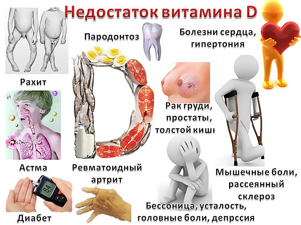 Последствия дефицита