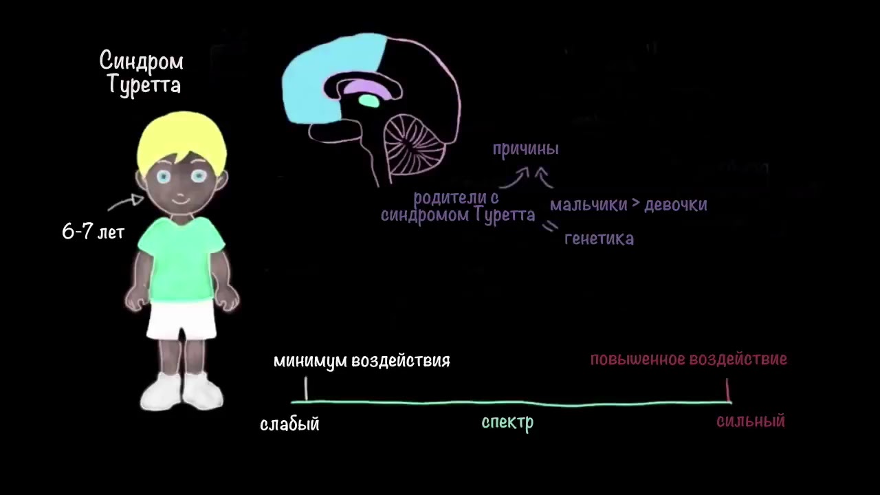 Синдром