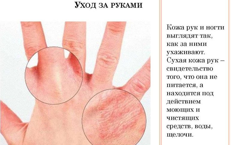 Уход за руками