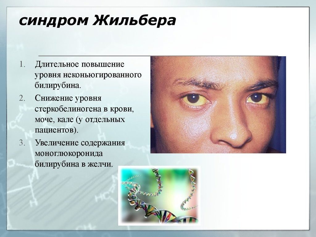 Желтизна