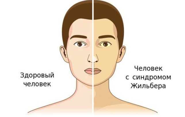 Разница