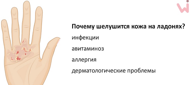 Причины шелушения кожи на ладонях