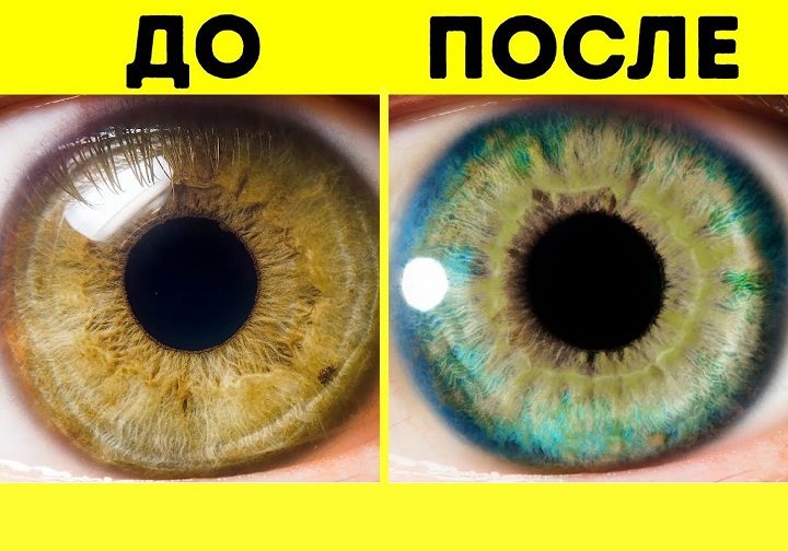 Сравнение зрачка после изменения в питании