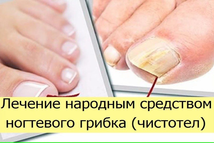 Комплексно