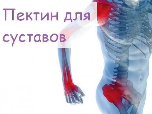 Пектин для суставов: польза. Какие желирующие вещества, пектины помогают восстанавливать суставы?
