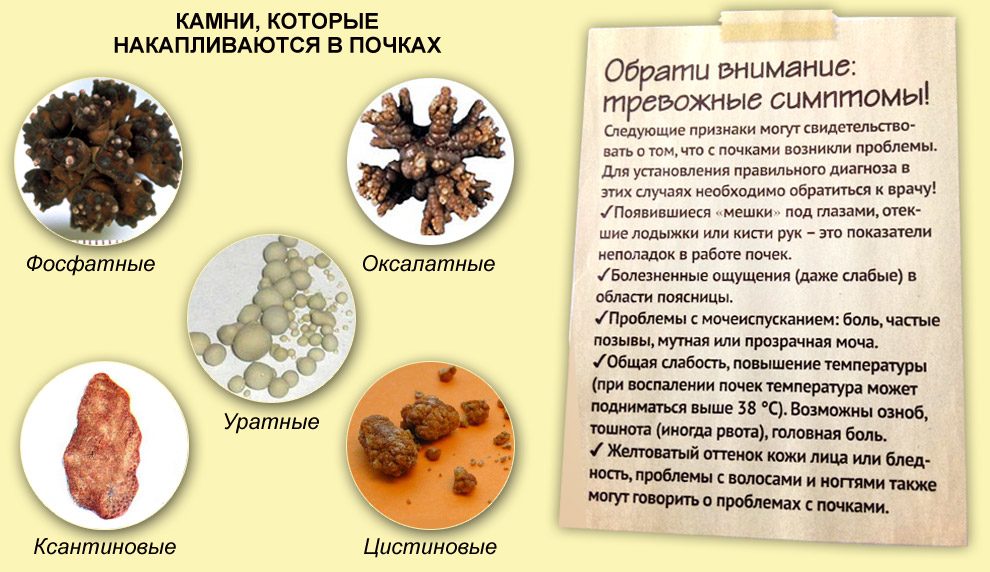 Камни