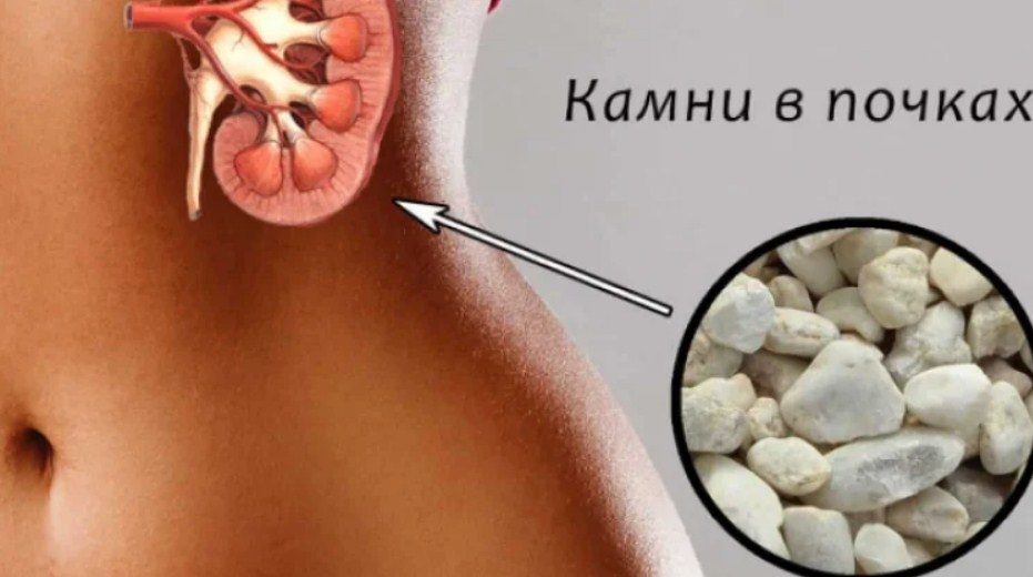 Камни