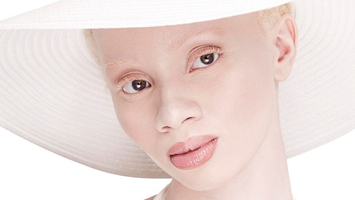 Тандо хопа (thando hopa)