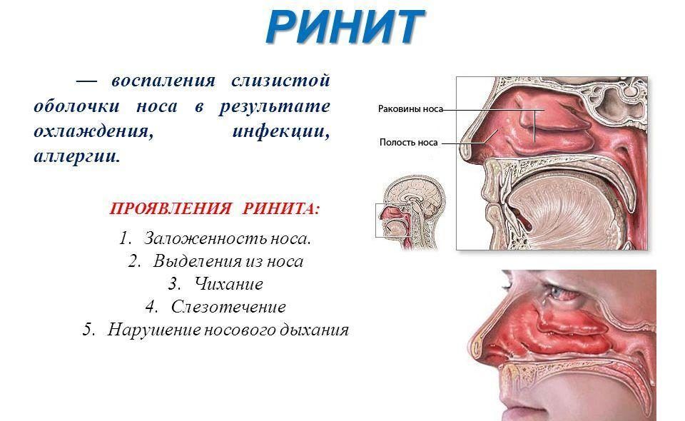 Воспаление
