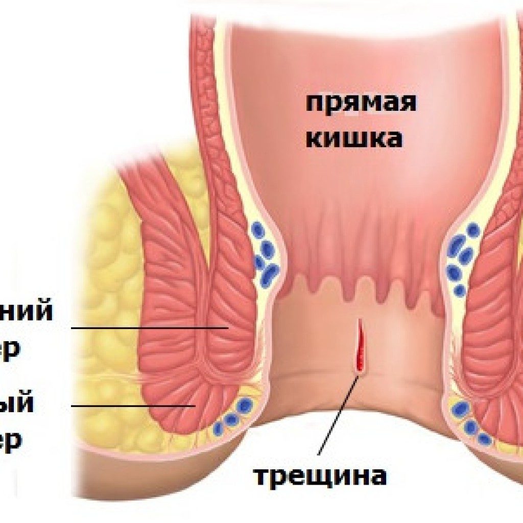 Визуализация