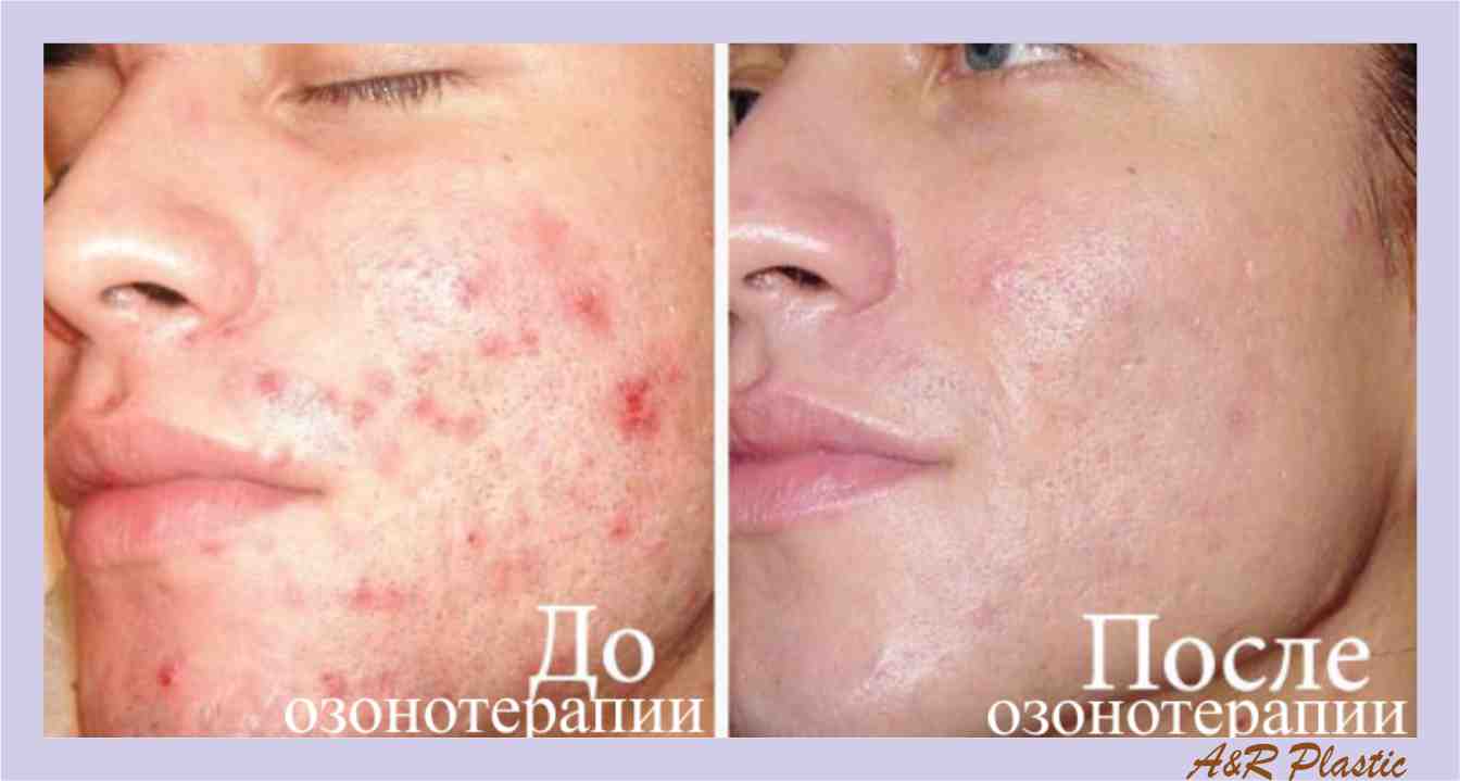 Фото до и после