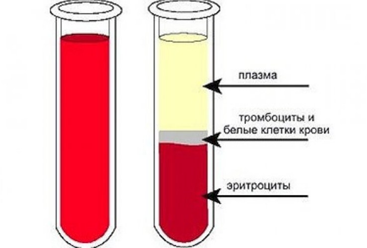 Разжижение и очищение