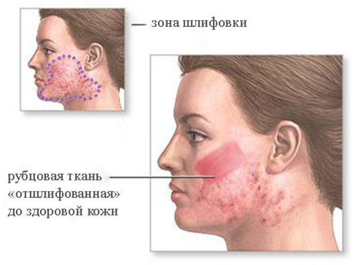 Действие