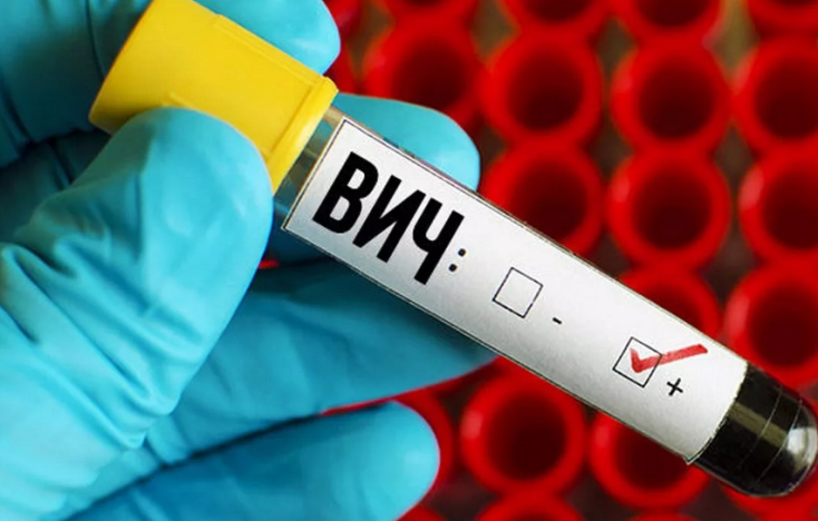 Вич-инфекция, как причина повышения температуры 37,0-37,5