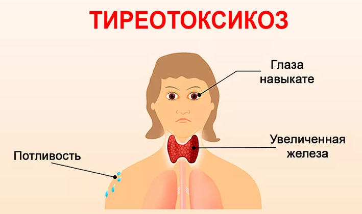 Болезни щитовидной железы — причина повышения температуры 37,0-37,5
