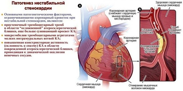 Выявление
