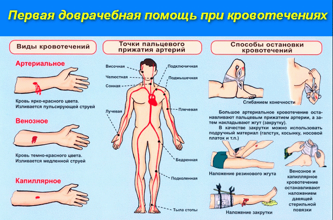 Выявите вид и правильно остановите кровотечение