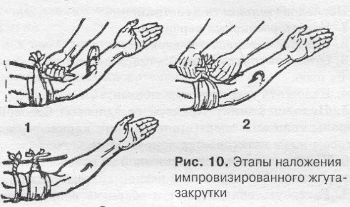 Импровизация во спасение