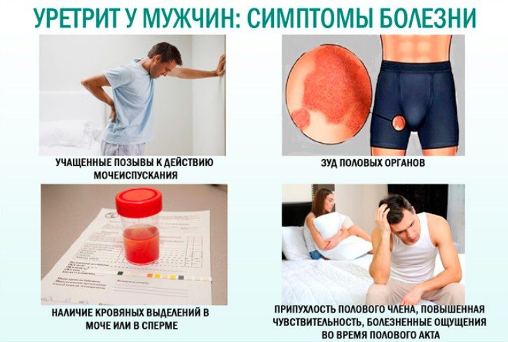 Выявление