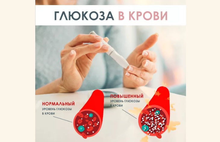 Интерпретация результатов, расшифровка