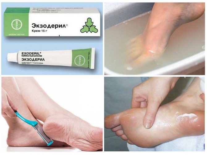 Лечение стопы мазью