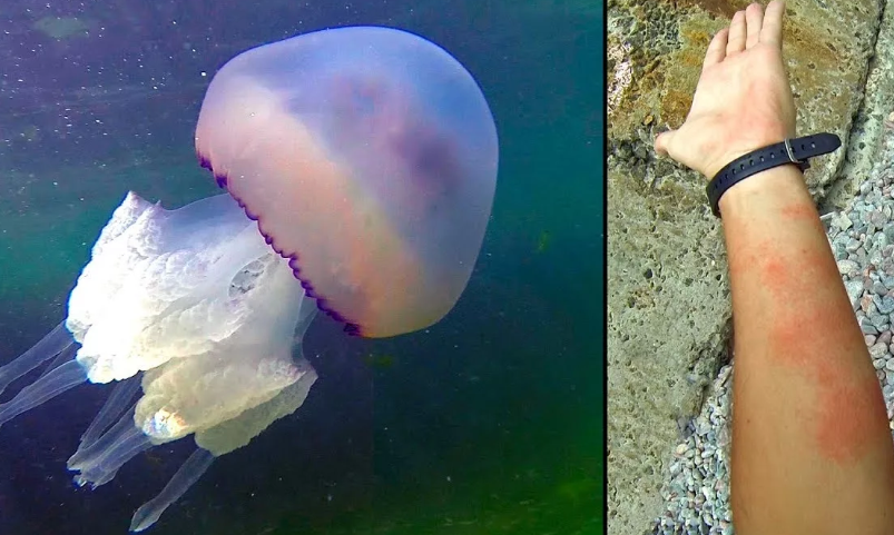 Медуза корнерот и ее укус — водится в черном море