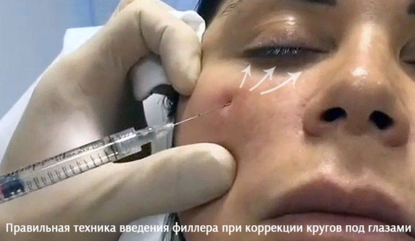 Правила