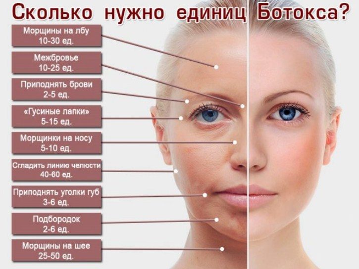 Колоть ботокс