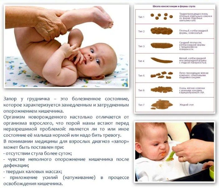 Запор у младенца