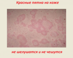 Красные пятна на коже не чешутся и не шелушатся: что это может быть?
