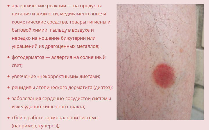 Красные пятна на коже