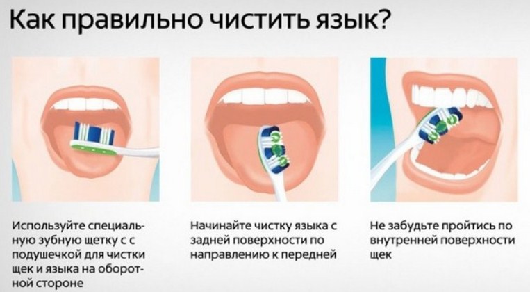 Правильная чистка языка