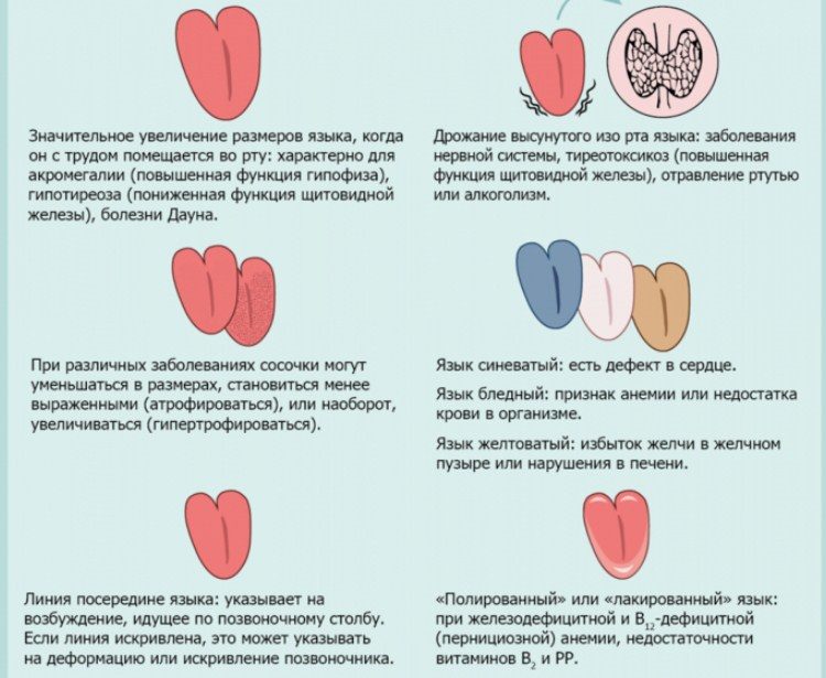Нужно смотреть на форму и цвет