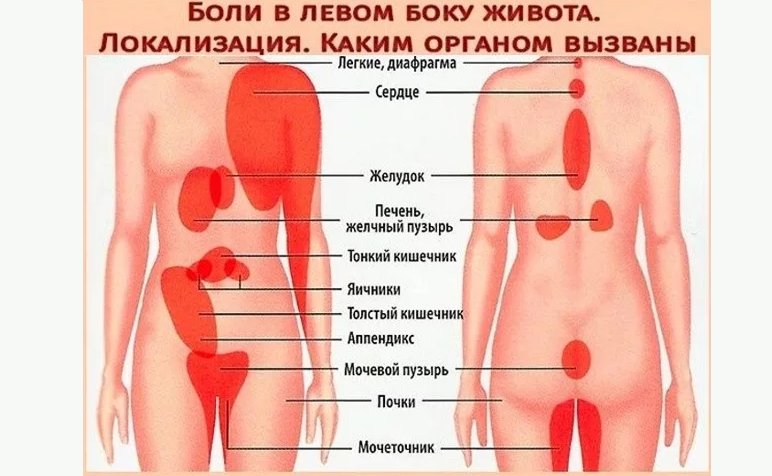 Ноющая боль слева в области пупка