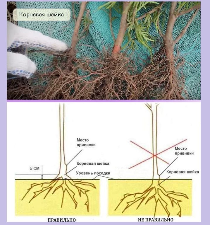 Схема углубления шейки
