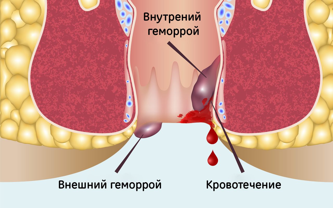 Болезнь