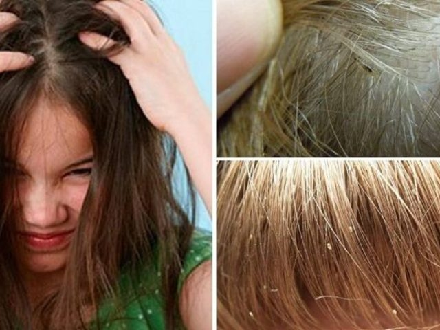 Сколько вши и гниды живут без головы человека?