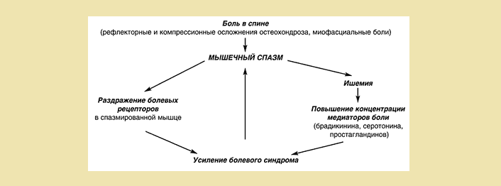 Продуло спину: вот так происходит мышечный спазм