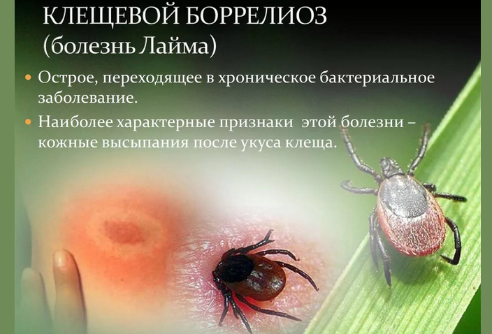Клещевой боррелиоз
