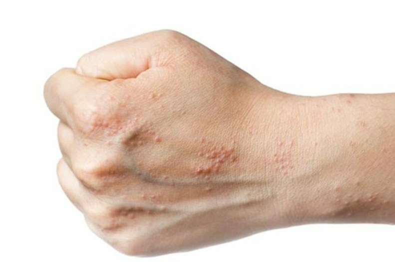Посмотрите, нет ли медицинских нюансов, по которым может появиться зуд
