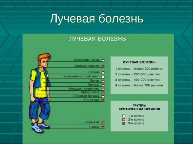 Лучевая болезнь: что это такое, кто подвержен, симптомы, причины и лечение