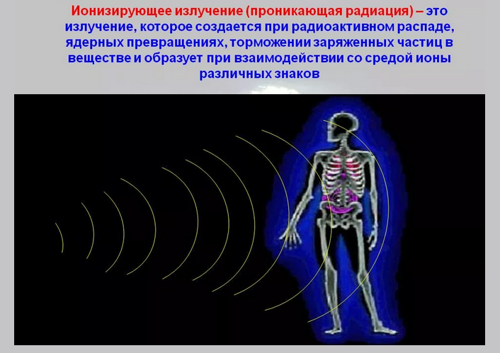 Ионизирующее излучение
