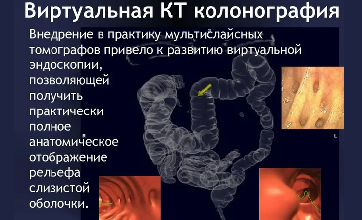 Проверка язвы двенадцатиперстной кишки: инструментальные методы