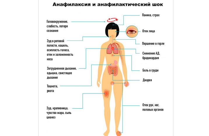 Последствия, если пошла аллергия на краску для волос после окрашивания