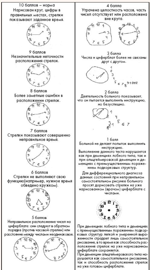 Часики