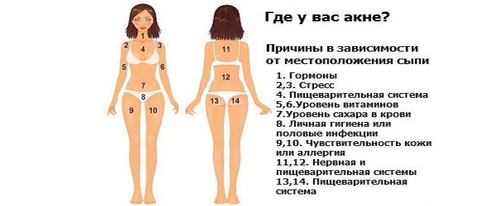 Что означают прыщи на разных частях тела?