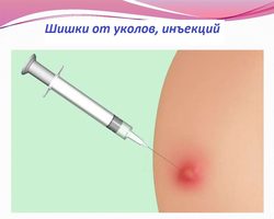 Эффективные методы устранения шишек от уколов на ягодицах: что делать, чем рассосать, как убрать гнойные уплотнения? Что делать, чтобы после укола не образовалась шишка: профилактика, какой используется шприц для подкожных инъекций?