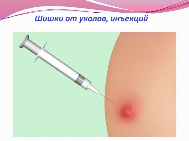 Эффективные методы устранения шишек от уколов на ягодицах: что делать, чем рассосать, как убрать гнойные уплотнения? Что делать, чтобы после укола не образовалась шишка: профилактика, какой используется шприц для подкожных инъекций?