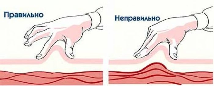 Правильное формирование складки для укола инсулина