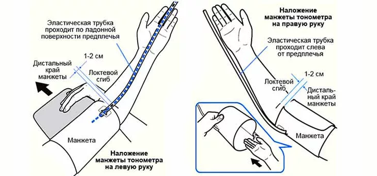 Чтобы не было разницы давления на разных руках, нужно правильно надеть манжету